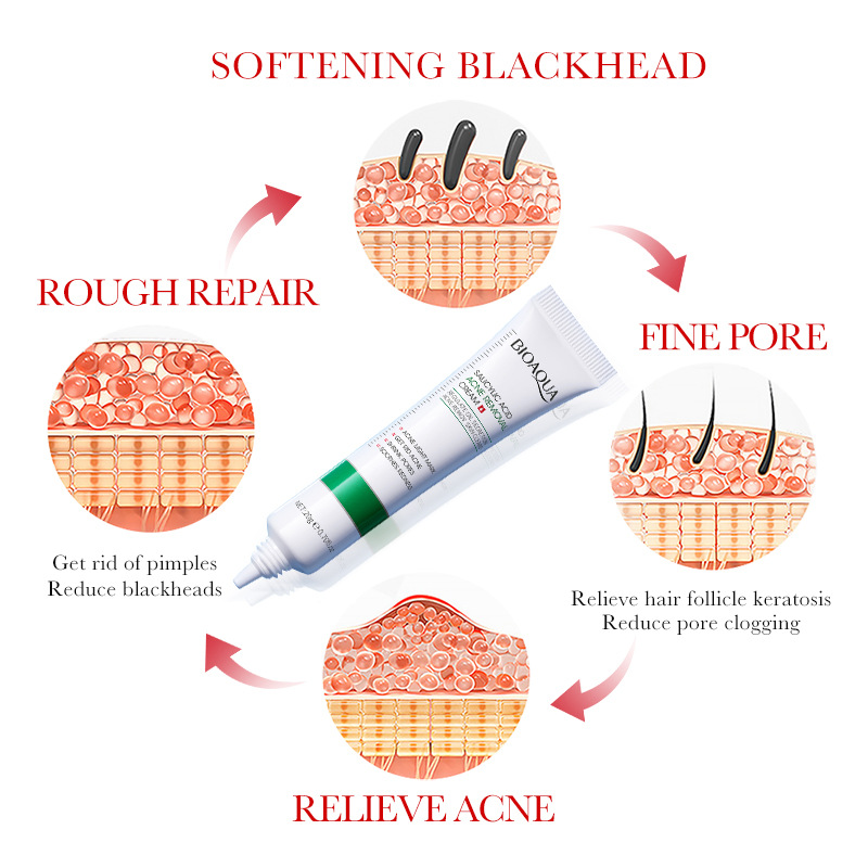 1/2/3pcs BIOAQUA Salicylic Aci - Salicylic Acid Blackhead Remover recension och pris