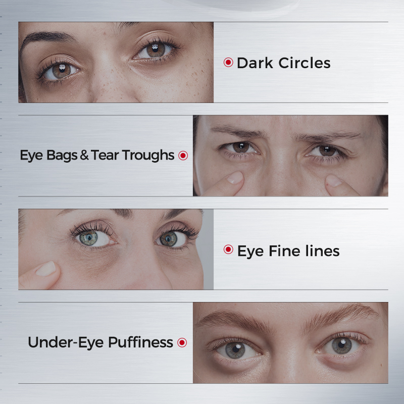 Eye Patches for Dark Circles – - Collagen Under Eye Patches recension och pris