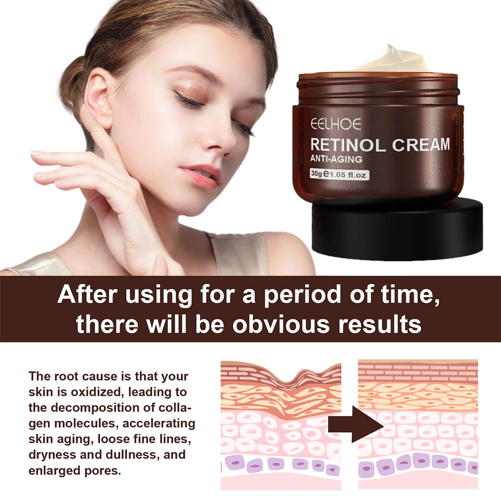 EELHOE 1/2/3/5PCS(Buy 3 Get 2  - Retinol Anti Wrinkle Cream recension och pris